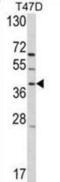 G Protein-Coupled Receptor Class C Group 5 Member A antibody, abx032746, Abbexa, Western Blot image 