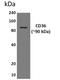 CD36 Molecule antibody, GTX52623, GeneTex, Western Blot image 