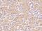 EARP Complex And GARP Complex Interacting Protein 1 antibody, 204280-T08, Sino Biological, Immunohistochemistry paraffin image 
