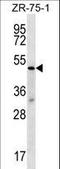 Transducin Beta Like 2 antibody, LS-C161746, Lifespan Biosciences, Western Blot image 