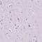 Cluster of Differentiation 10 antibody, HPA056072, Atlas Antibodies, Immunohistochemistry frozen image 