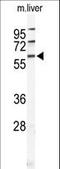 Hyaluronan Binding Protein 2 antibody, LS-C166772, Lifespan Biosciences, Western Blot image 