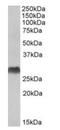 Major Histocompatibility Complex, Class II, DQ Alpha 2 antibody, orb125058, Biorbyt, Western Blot image 
