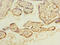 ADP Ribosylation Factor Like GTPase 8A antibody, LS-C379507, Lifespan Biosciences, Immunohistochemistry paraffin image 