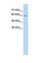 Cytochrome P450 Family 4 Subfamily F Member 11 antibody, NBP1-69423, Novus Biologicals, Western Blot image 