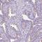 Transmembrane Protein 89 antibody, HPA053577, Atlas Antibodies, Immunohistochemistry paraffin image 