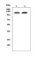 PMS1 Homolog 2, Mismatch Repair System Component antibody, A01028-1, Boster Biological Technology, Western Blot image 