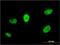 Polycomb Group Ring Finger 5 antibody, H00084333-M01, Novus Biologicals, Immunofluorescence image 