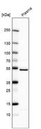 Mast cell carboxypeptidase A antibody, NBP1-86130, Novus Biologicals, Western Blot image 