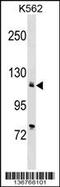 ATPase Sarcoplasmic/Endoplasmic Reticulum Ca2+ Transporting 2 antibody, 58-877, ProSci, Western Blot image 