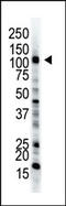 UBA1 antibody, AP11969PU-N, Origene, Western Blot image 