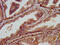 Transient Receptor Potential Cation Channel Subfamily V Member 2 antibody, CSB-PA897571LA01HU, Cusabio, Immunohistochemistry frozen image 