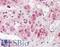 NIMA Related Kinase 9 antibody, LS-A7968, Lifespan Biosciences, Immunohistochemistry paraffin image 