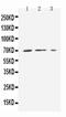 Solute Carrier Family 16 Member 1 antibody, PA5-80007, Invitrogen Antibodies, Western Blot image 