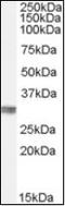 Chloride Intracellular Channel 4 antibody, orb88161, Biorbyt, Western Blot image 