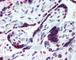 High Mobility Group AT-Hook 1 antibody, 49-286, ProSci, Immunohistochemistry paraffin image 