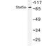 Signal Transducer And Activator Of Transcription 5A antibody, LS-C176762, Lifespan Biosciences, Western Blot image 