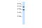 Tripartite Motif Containing 31 antibody, 28-172, ProSci, Western Blot image 