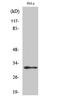 Mitochondrial Ribosomal Protein L46 antibody, STJ94230, St John