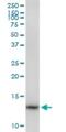 Cyclin Dependent Kinase 2 Associated Protein 2 antibody, H00010263-B01P, Novus Biologicals, Western Blot image 