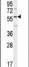 FAM20C Golgi Associated Secretory Pathway Kinase antibody, PA5-24463, Invitrogen Antibodies, Western Blot image 