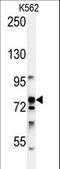 Ribosomal Protein S6 Kinase A1 antibody, LS-C162747, Lifespan Biosciences, Western Blot image 