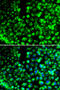 Calumenin antibody, STJ114282, St John