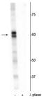 AKT1 Substrate 1 antibody, P03629, Boster Biological Technology, Western Blot image 