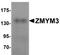 Zinc Finger MYM-Type Containing 3 antibody, TA319770, Origene, Western Blot image 