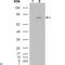 Fibroblast Growth Factor Receptor 4 antibody, LS-C812467, Lifespan Biosciences, Immunohistochemistry paraffin image 