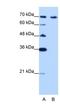 CDKN2A Interacting Protein antibody, NBP1-57236, Novus Biologicals, Western Blot image 