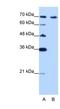 CaRF antibody, NBP1-57236, Novus Biologicals, Western Blot image 