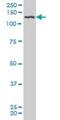 Platelet Derived Growth Factor Receptor Beta antibody, H00005159-M08, Novus Biologicals, Western Blot image 