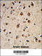 G Protein-Coupled Receptor Kinase 3 antibody, 63-777, ProSci, Immunohistochemistry paraffin image 