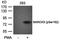 Myristoylated Alanine Rich Protein Kinase C Substrate antibody, orb15024, Biorbyt, Western Blot image 