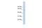 CDC Like Kinase 4 antibody, GTX44602, GeneTex, Western Blot image 