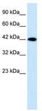 Purinergic Receptor P2X 2 antibody, TA338777, Origene, Western Blot image 