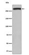 ATM Serine/Threonine Kinase antibody, M00014-1, Boster Biological Technology, Western Blot image 