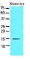 Cellular Retinoic Acid Binding Protein 1 antibody, LS-B3590, Lifespan Biosciences, Western Blot image 
