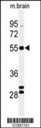 Fatty Acid 2-Hydroxylase antibody, 61-669, ProSci, Western Blot image 