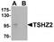 Teashirt Zinc Finger Homeobox 2 antibody, TA320096, Origene, Western Blot image 