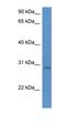 UTP23 Small Subunit Processome Component antibody, orb326347, Biorbyt, Western Blot image 