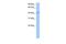 Germ Cell Associated 1 antibody, GTX45454, GeneTex, Western Blot image 