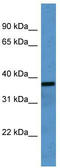 Olfactory Receptor Family 2 Subfamily H Member 1 antibody, TA342711, Origene, Western Blot image 