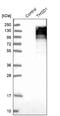 Thrombospondin Type 1 Domain Containing 1 antibody, NBP1-86930, Novus Biologicals, Western Blot image 