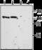 Sortilin 1 antibody, GTX54854, GeneTex, Western Blot image 