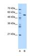 Muscleblind Like Splicing Regulator 1 antibody, orb330163, Biorbyt, Western Blot image 