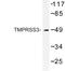 Transmembrane Serine Protease 3 antibody, LS-B10957, Lifespan Biosciences, Western Blot image 