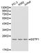 Glutathione S-Transferase Pi 1 antibody, abx126926, Abbexa, Western Blot image 