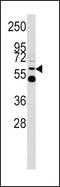 UDP Glucuronosyltransferase Family 2 Member B17 antibody, GTX81884, GeneTex, Western Blot image 